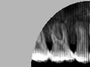 Simulated X-ray image